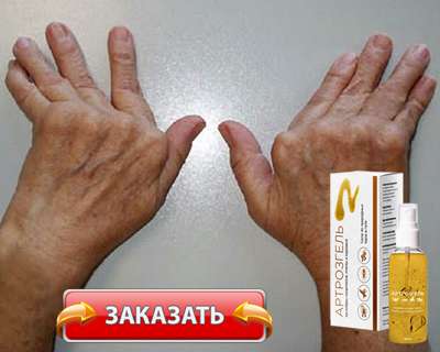 Гель Артрозгель купить по доступной цене.